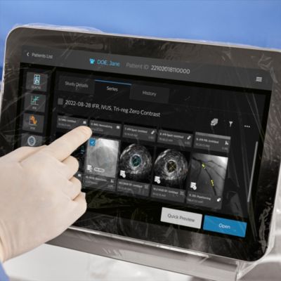 Bedienung des IntraSight plus am Touch Pad