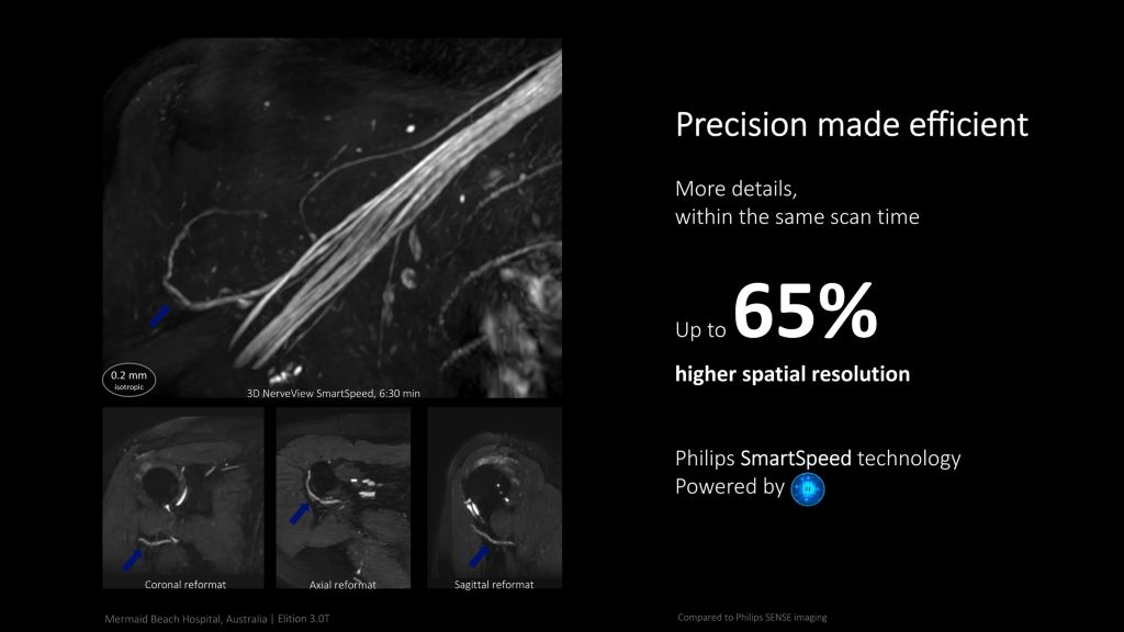 Precision made efficient with Elition X