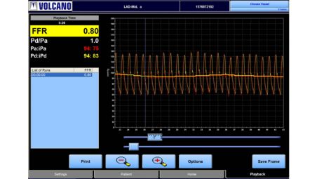 Fractional Flow Reserve measurement