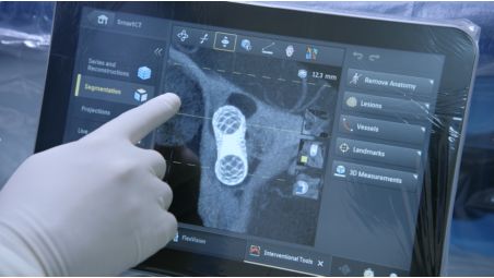 Direct image inspection with advanced 3D visualization at tableside​
