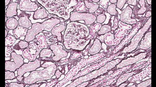 Clinical image digital pathology