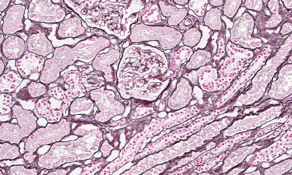 Clinical image digital pathology