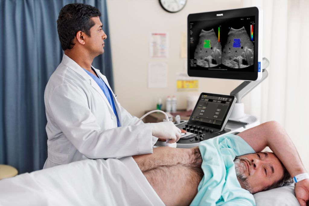 EPIQ Elite liver scan with C5-1