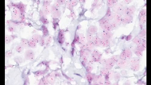 Clinical image digital pathology