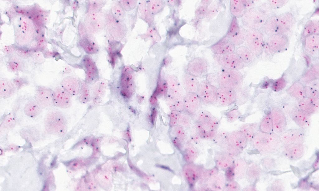 Clinical image digital pathology