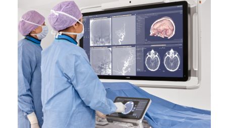 CT-like imaging in the radiology interventional lab can free up the CT scanner for diagnostic purposes​