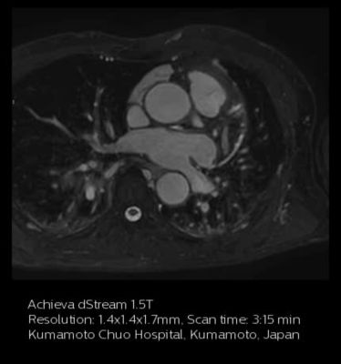 Coronary Acquisition