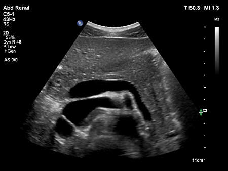C5-1 Pancreas Imaging