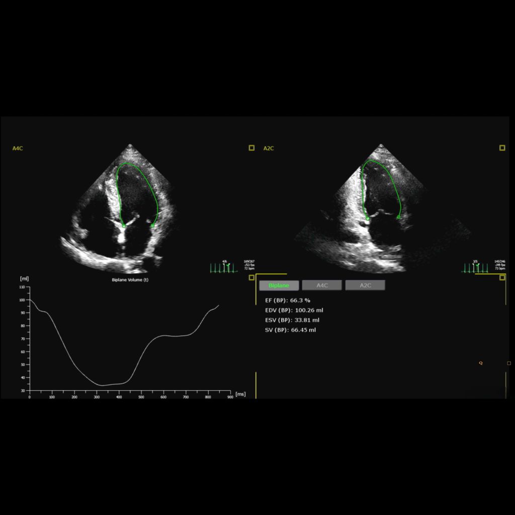 Affiniti CVx: 2D Auto EF and 2D Auto EF Advanced