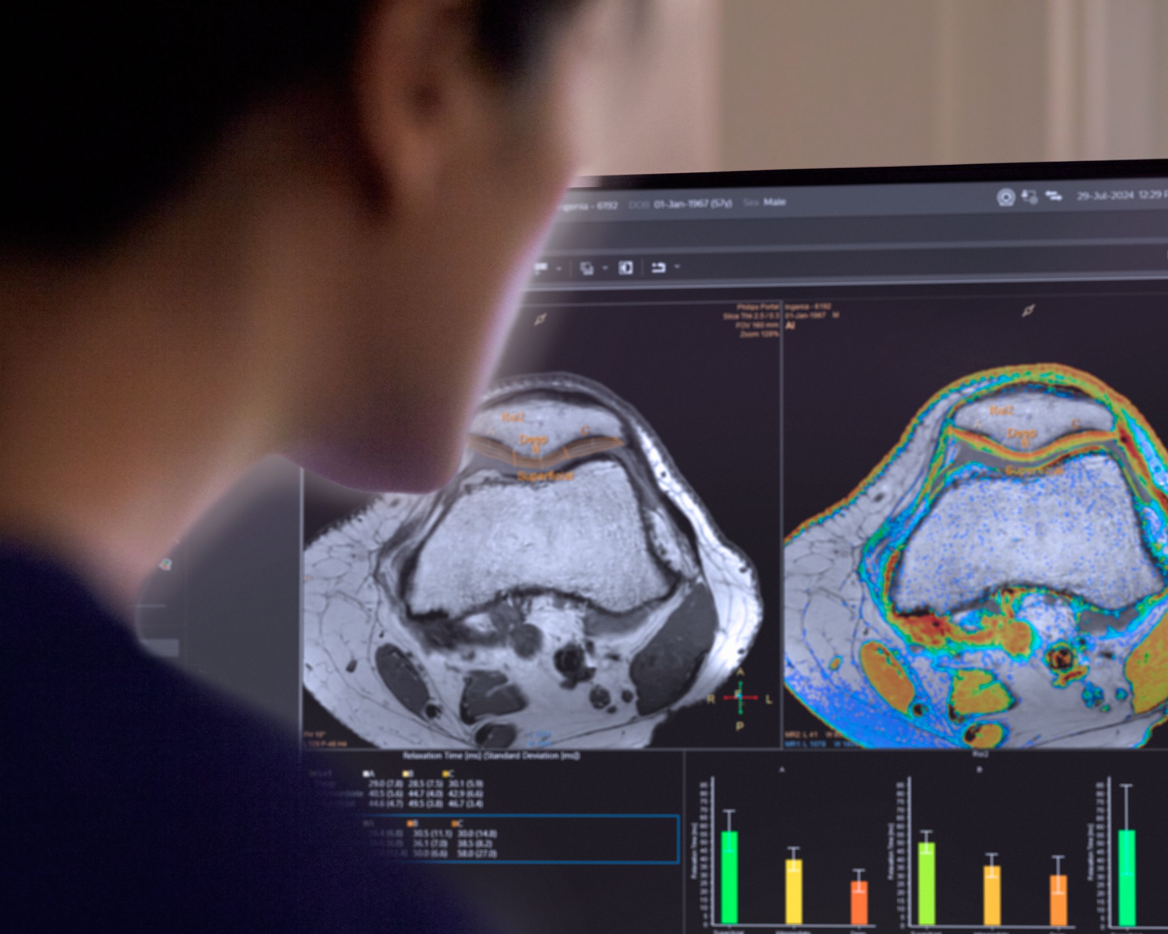 -	Technologist behind MR console using expert guidance for efficient post-processing