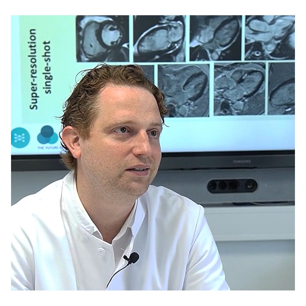 Testimonial video SmartSpeed Precise Julian Luetkens