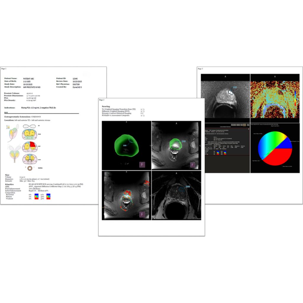 Exceptionally data-rich patient reports