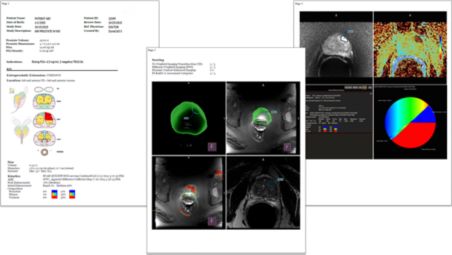 Exceptionally data-rich patient reports