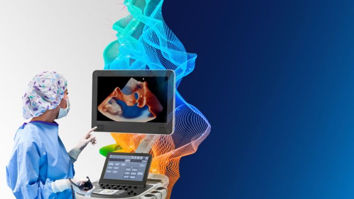 Philips EPIQ Ultrasound machine