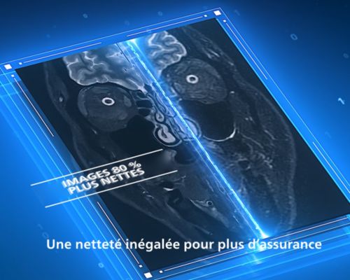 Image SmartSpeed Precise illustrant la nettet&eacute; de l&rsquo;image