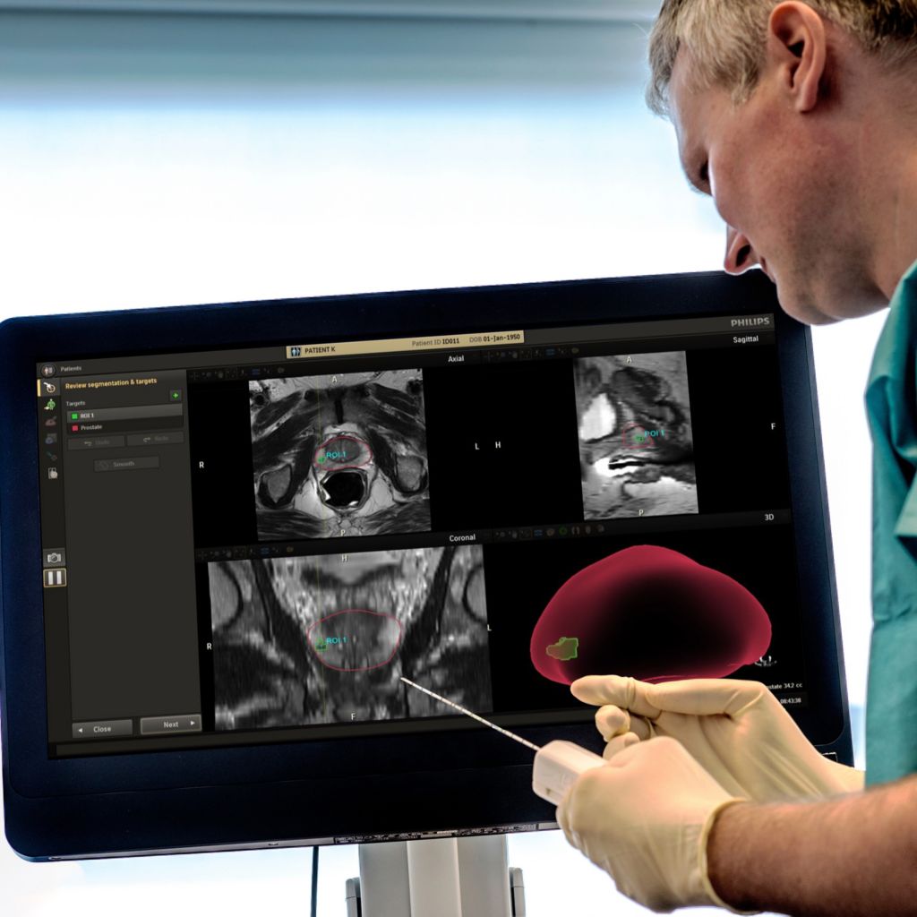 UroNav MR/US-guided prostate biopsies