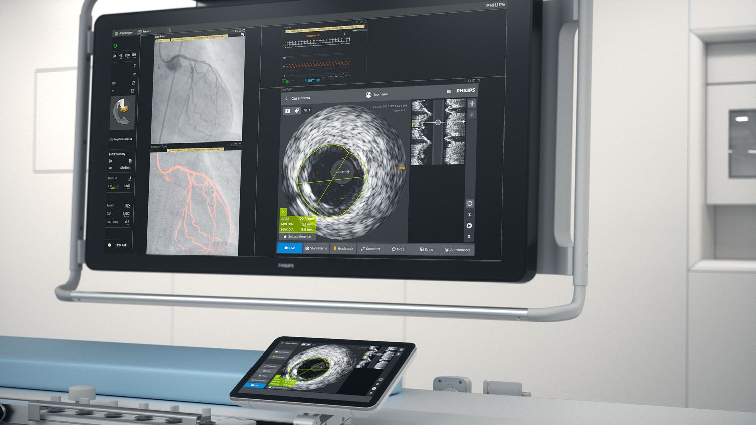 Plateforme de cardiologie interventionnelle