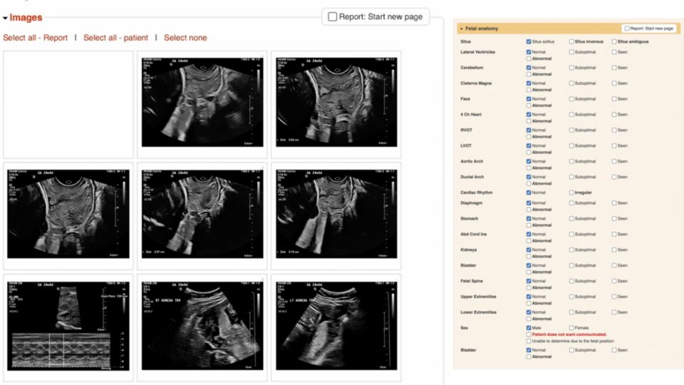 Fetview Patient Report
