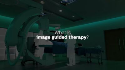 What is image guided therapy? - Get in the Know with Dr. Atul Gupta (Video thumbail)

