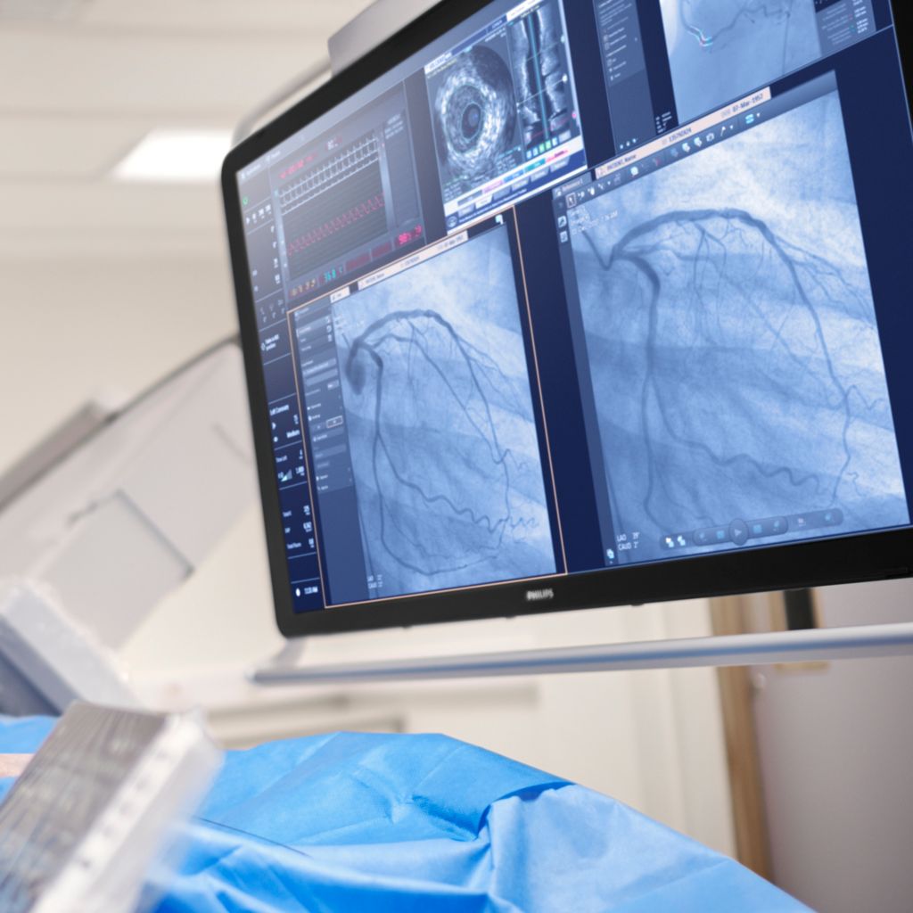 Philips Azurion 7C12 PCI image in Exam Room