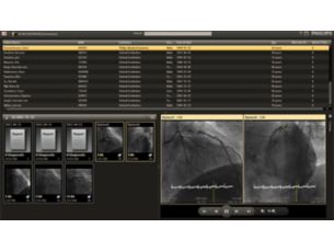 Xcelera Программа просмотра Cardiology Enterprise Viewer