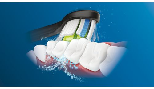 A Philips Sonicare továbbfejlesztett szónikus technológiája