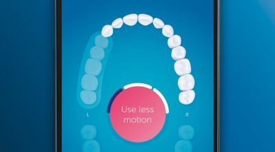 Sutelkia dėmesį į valymą ir pabrėžia praleistas vietas