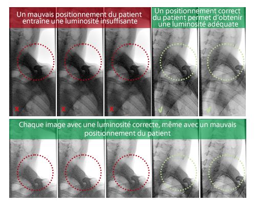 Stabilisation de la luminosit&eacute;