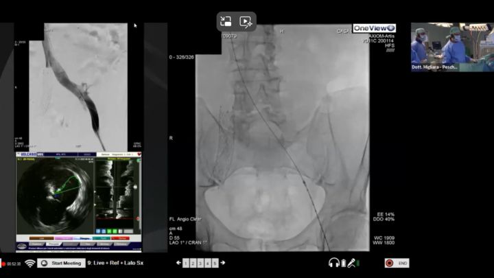 Видео на англ по периферическим артериям