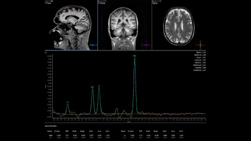 Spectroscopy Imaging