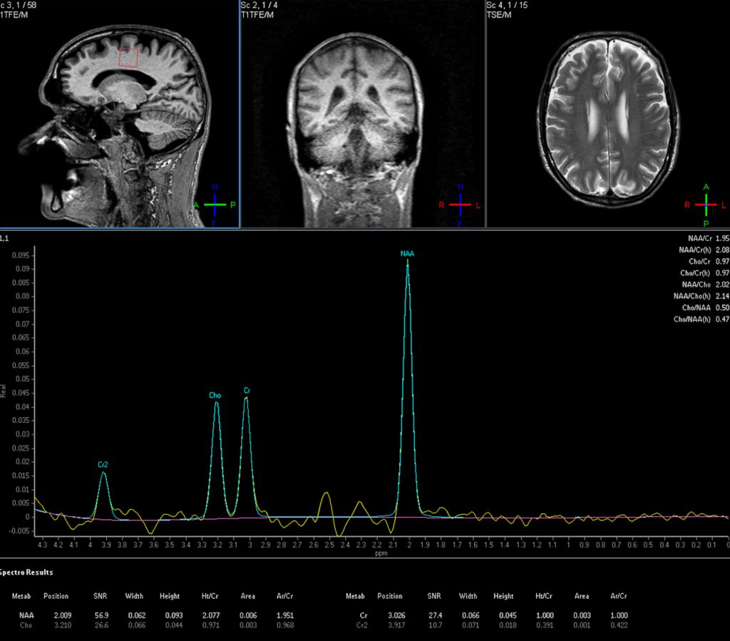 Spectroscopy Imaging