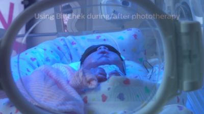 Using the BiliChek during and after phototherapy