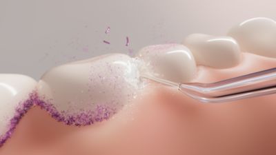 Un nettoyage doux mais efficace, même dans les zones difficiles d'accès