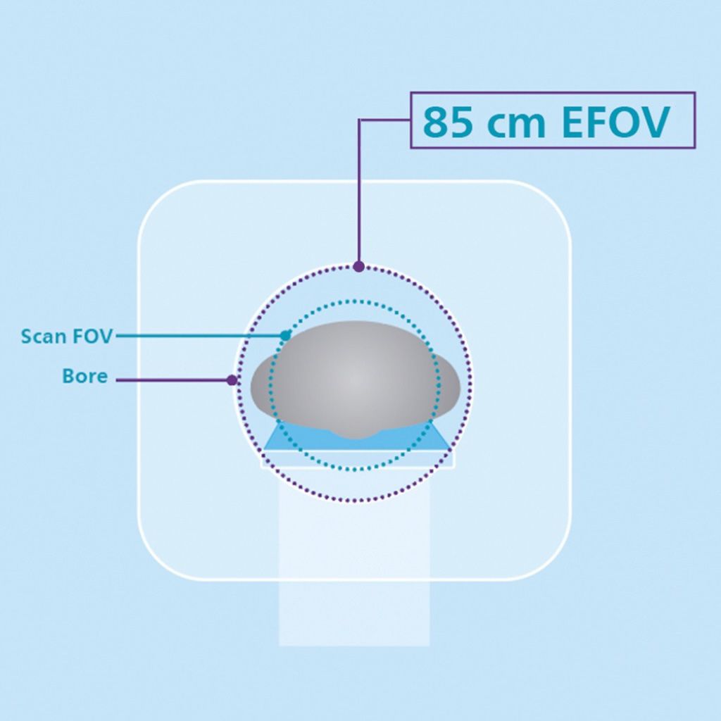 85 cm bore – largest in its class for patient access, comfort