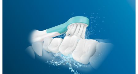 Sonicare technology helps prevent cavities