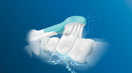 Sonicare tehnoloogia aitab kaariest ennetada