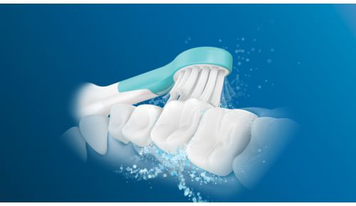 Sonicare-teknologi hjælper med at forebygge huller