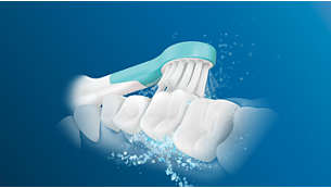 Sonicare-teknik hjälper till att förhindra hål i tänderna