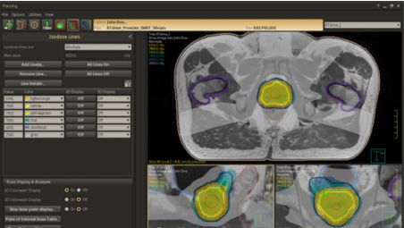 Accuracy in dose planning