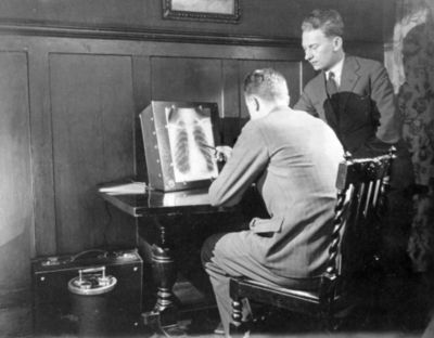 Sistema histórico de visualización de radiografías de tórax de Philips utilizado por profesionales sanitarios