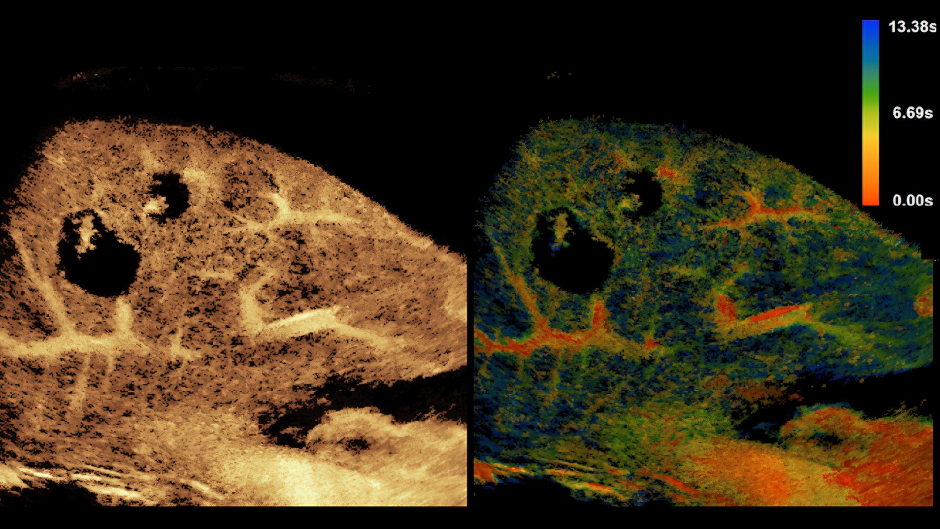 clinical image of liver scan