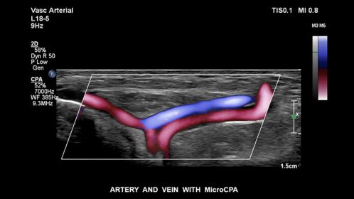 Artery and vein with MicroCPA