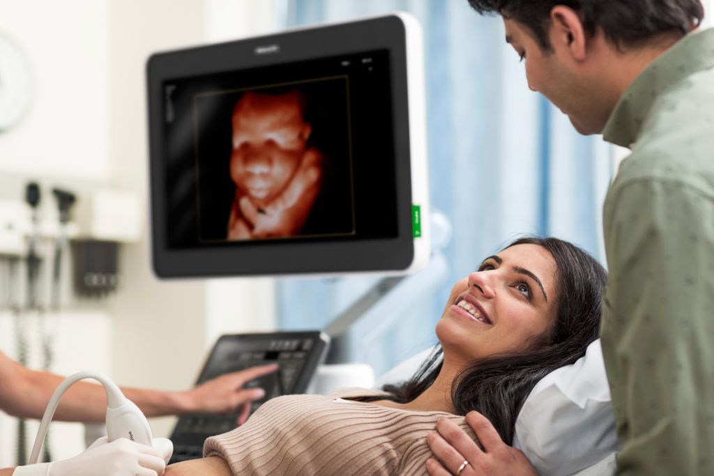 EPIQ Elite OB scan with V9-2 with mother and father