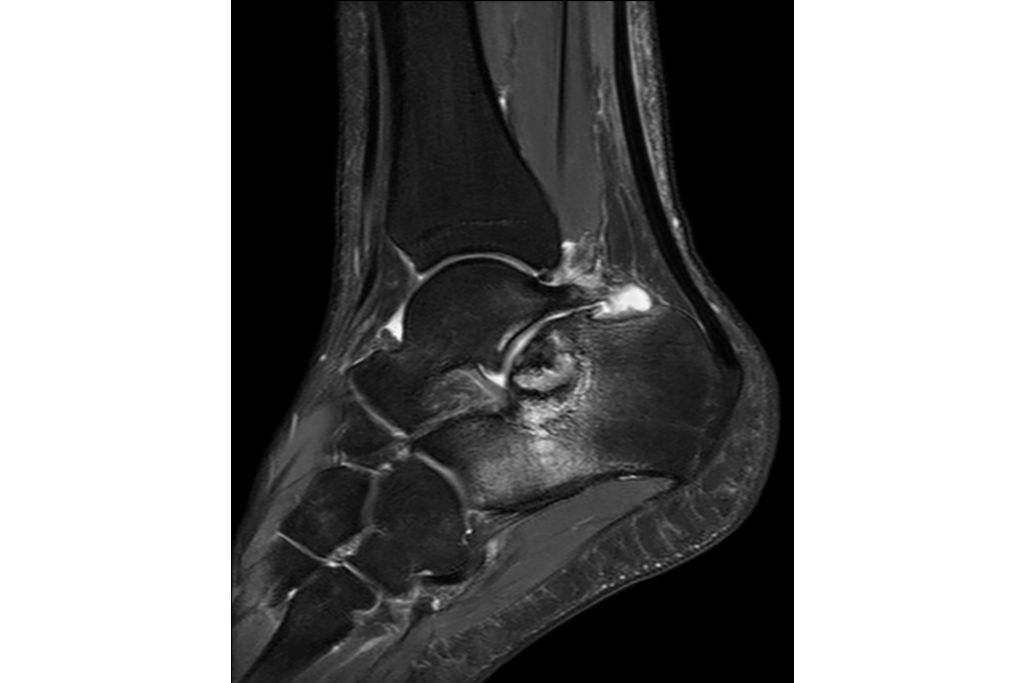 Sagittal T2w mDIXON