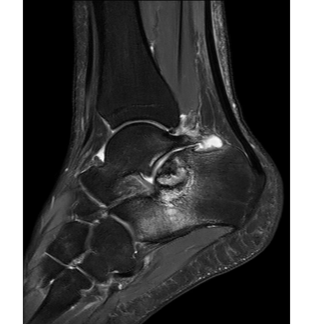 Sagittal T2w mDIXON