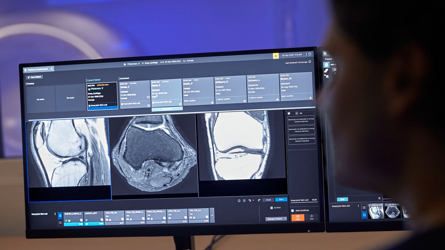 MR Day Manager shows which patients have arrived and allows to already prepare for their MRI scan in advance