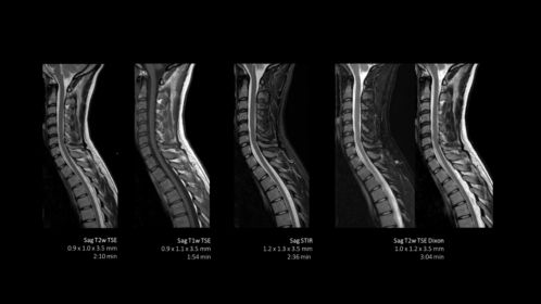 2D C-spine multi contrast with SmartSpeed