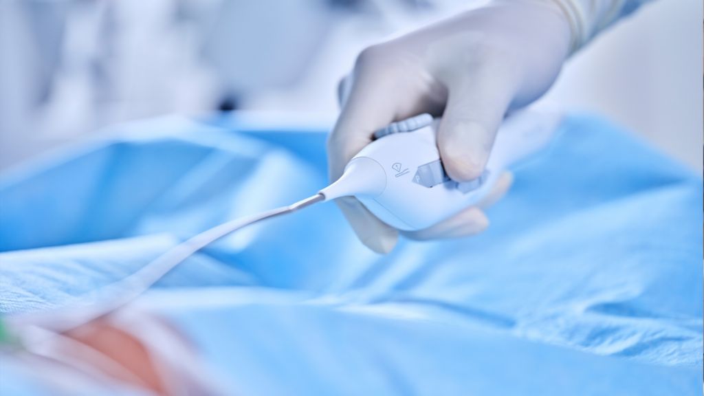 More control, fewer catheter manipulations [4]