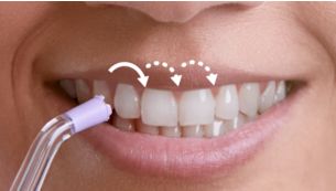 歯間移動ガイドが歯間から歯間に移るタイミングをお知らせ