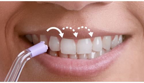 Pulse Wave-teknologi guider dig fra tand til tand